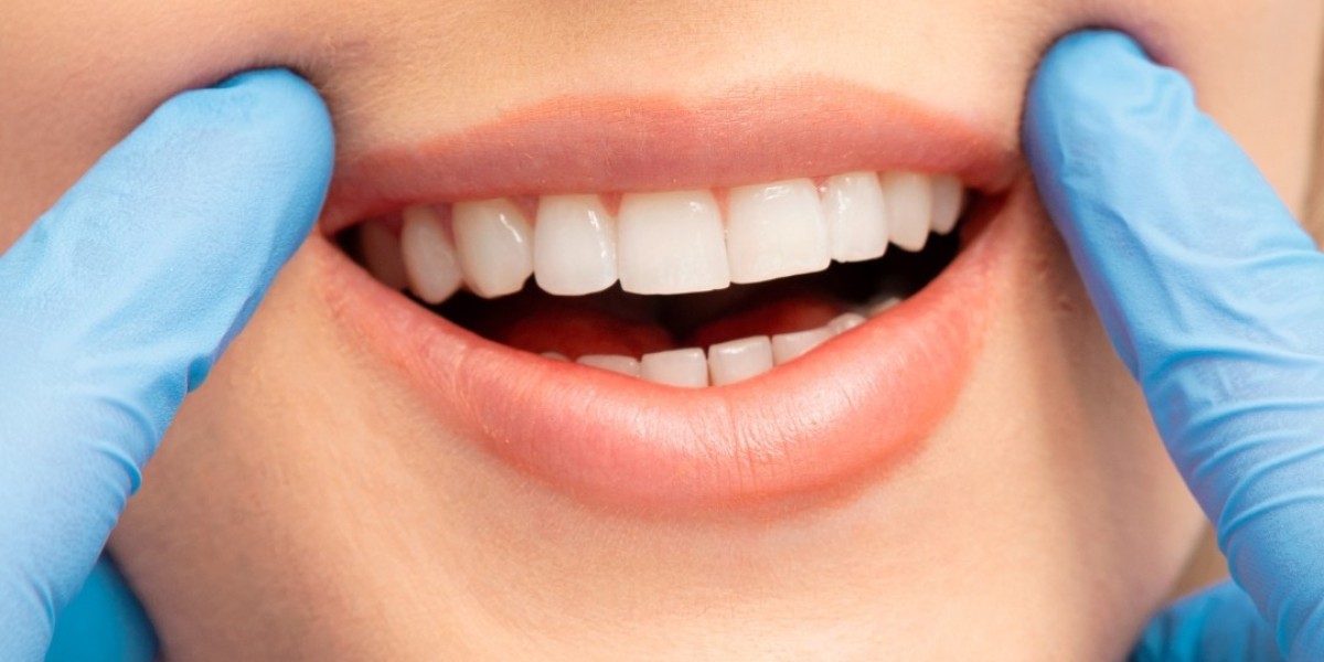 Is Professional Whitening Bad for Your Teeth?