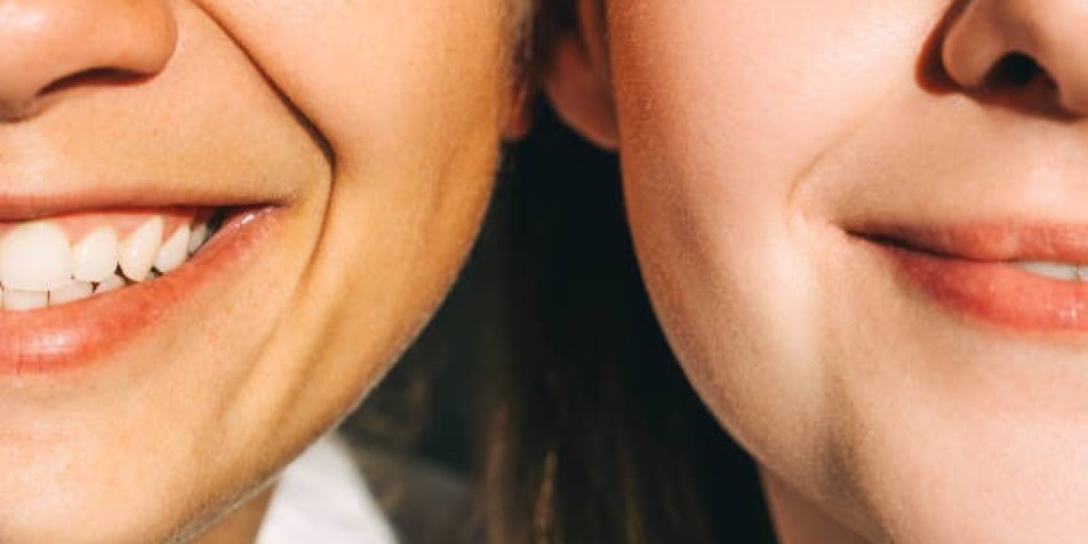 Plastic Surgery and Self-Esteem: The Positive I
