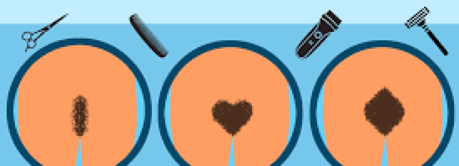 seo expert Cover Image