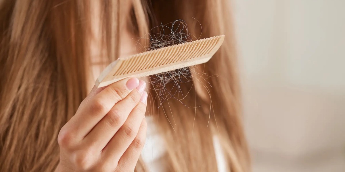 Hair Loss Treatment Dubai That Brings the Wow