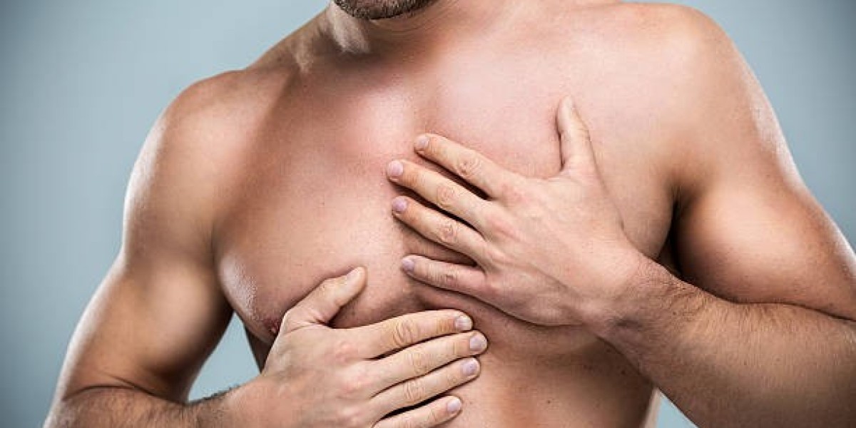 Understanding the Causes of Gynecomastia in