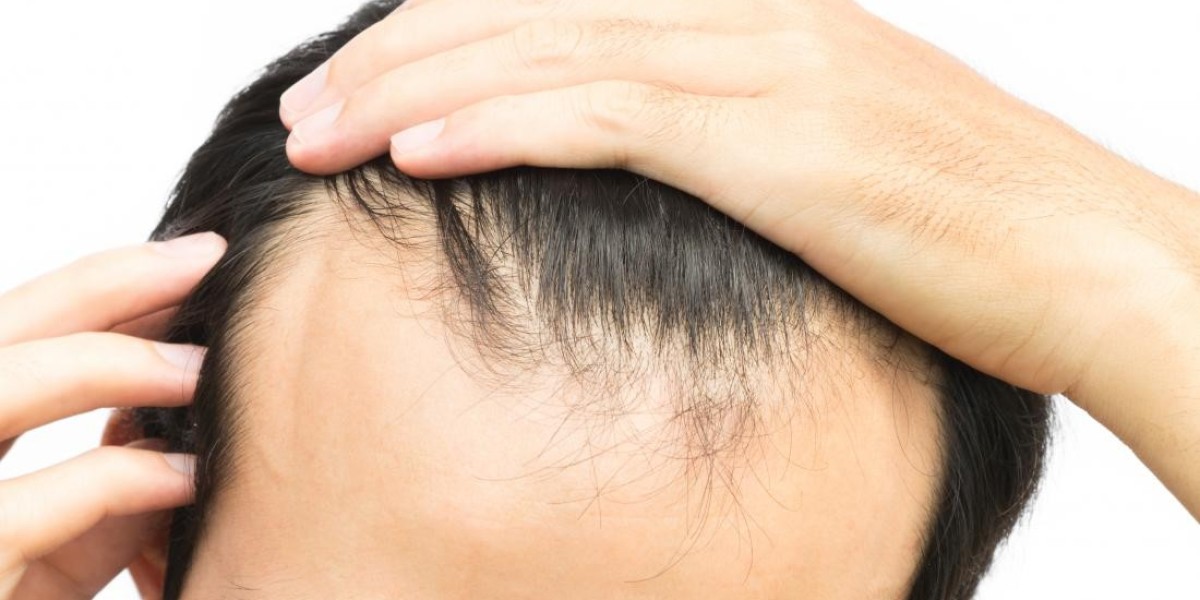How Front Line Hair Fixing Works