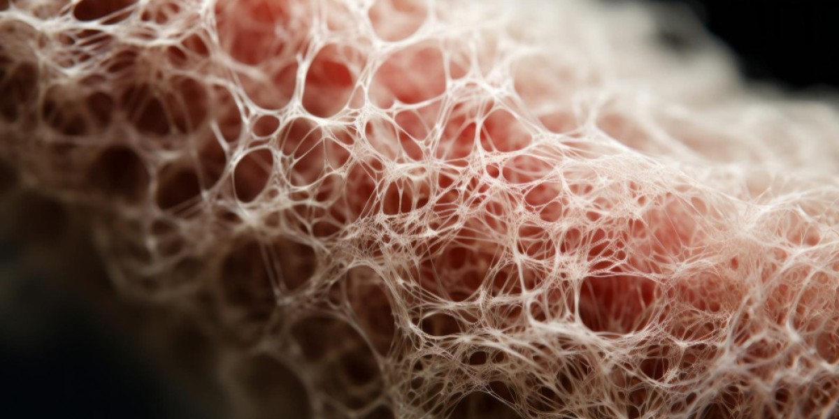 Systemic Sclerosis Market