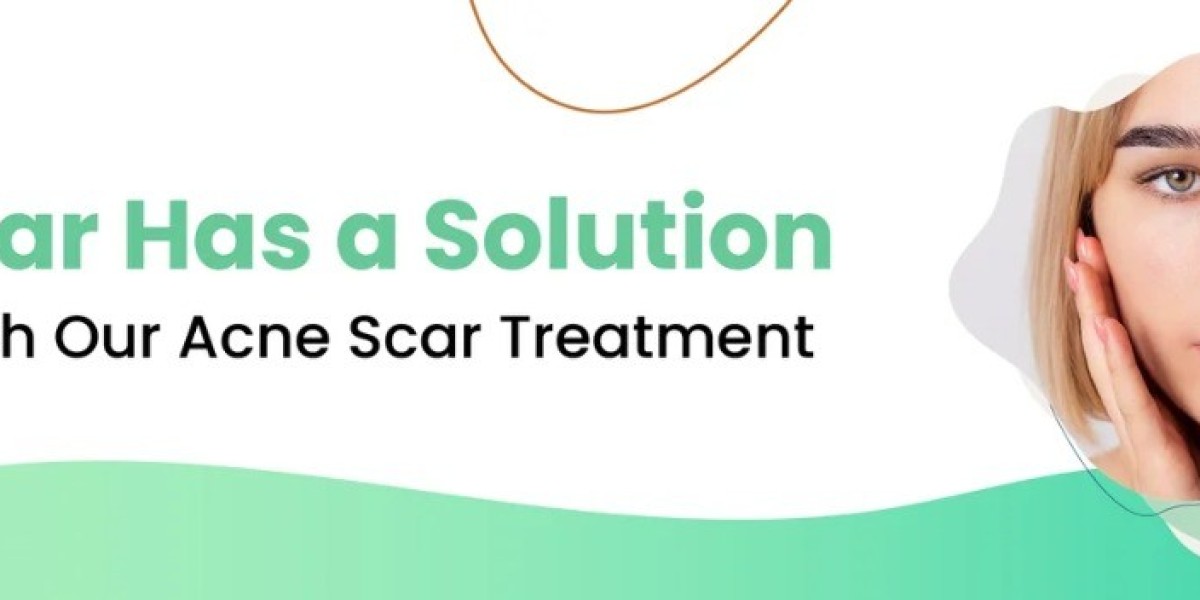 Discover Laser Hair Removal in Bangalore: A Lon