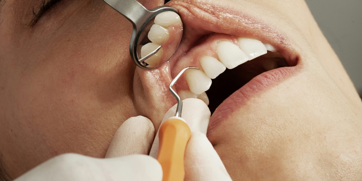 Oral Surgery West Covina