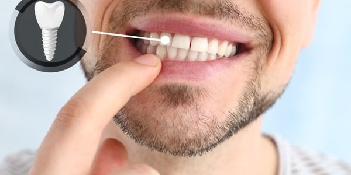 The Role of Dental Implants in Professional App