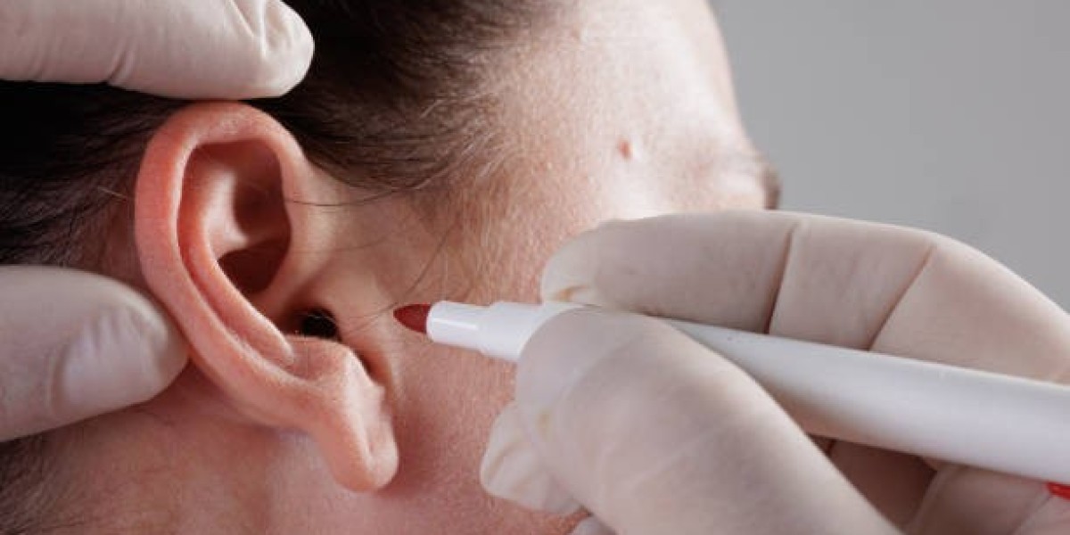 جراحة تجميل الأذن في الرياض.. احصل على مظهر شبا