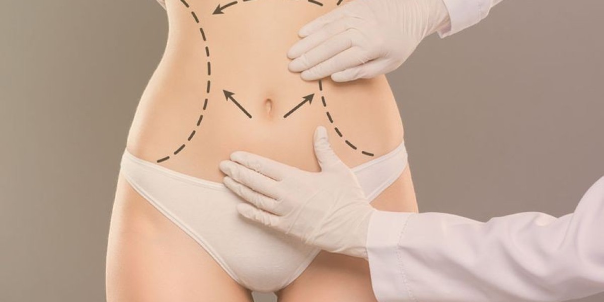Breast Augmentation in Dubai & Tummy Tuck Surge
