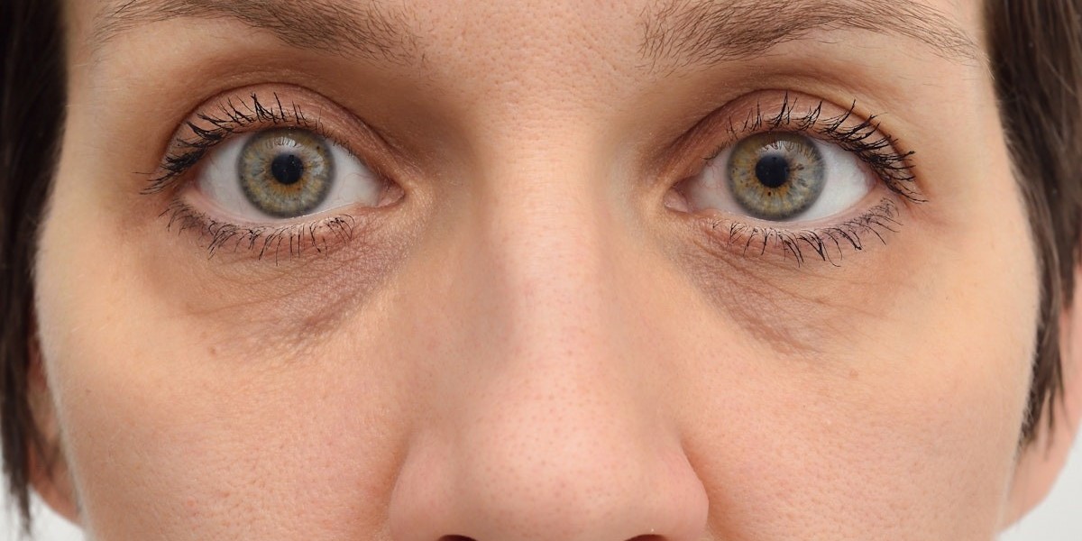 Improve Vision & Aesthetics: The Dual Benefits
