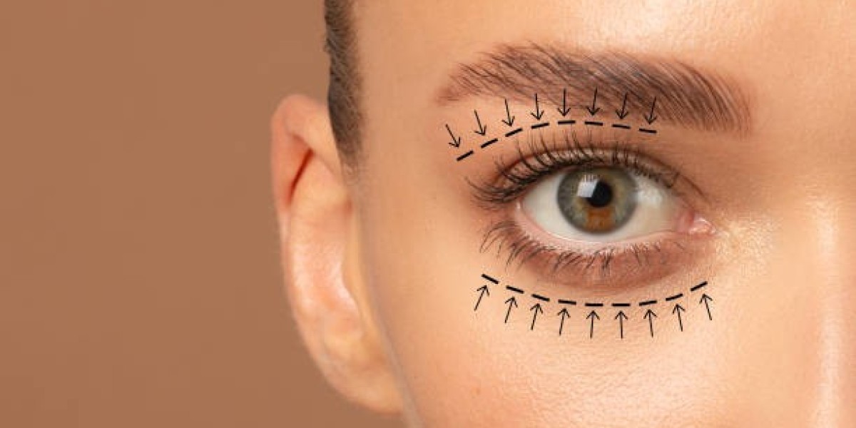 جراحة رأب الجفن في الرياض: تجميل العيون بثقة وا