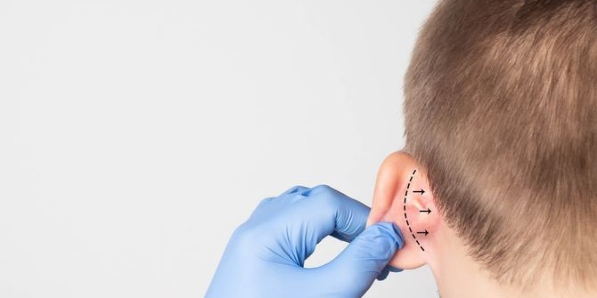 What to Expect from Riyadh Ear Plastic Surgery