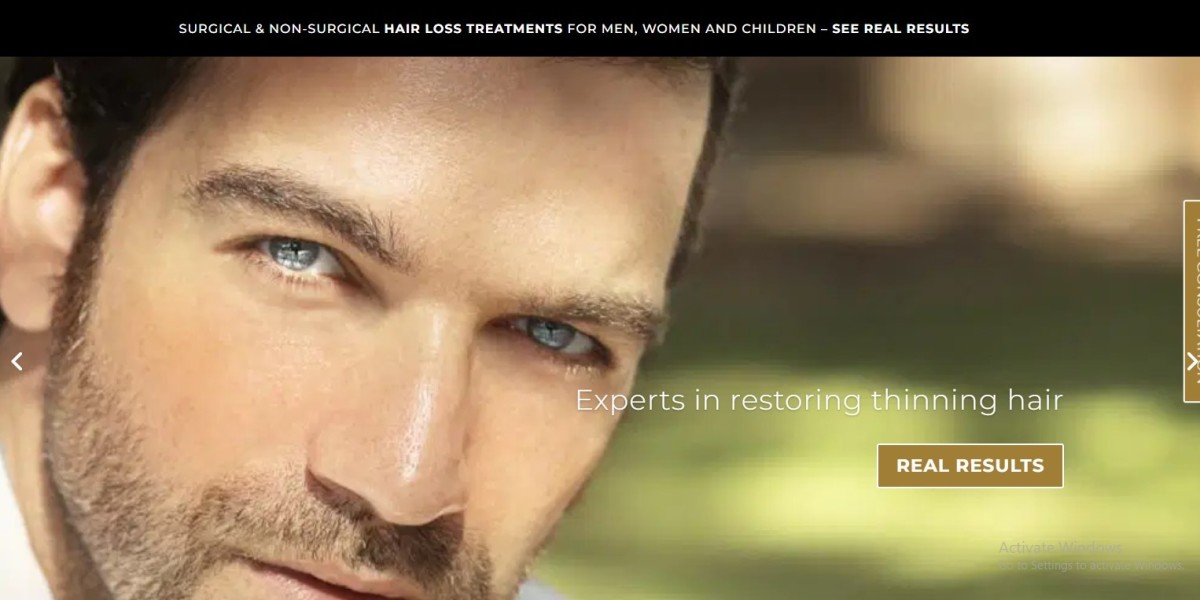 Best Hair Loss Consultations in Yorkshire