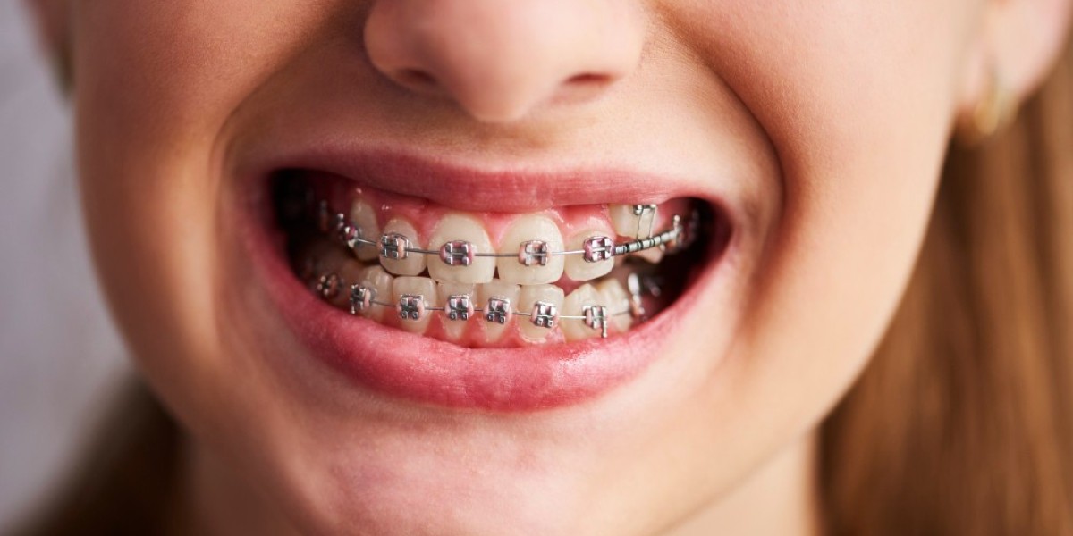 Qualities of the Best Pediatric Dentist in Las