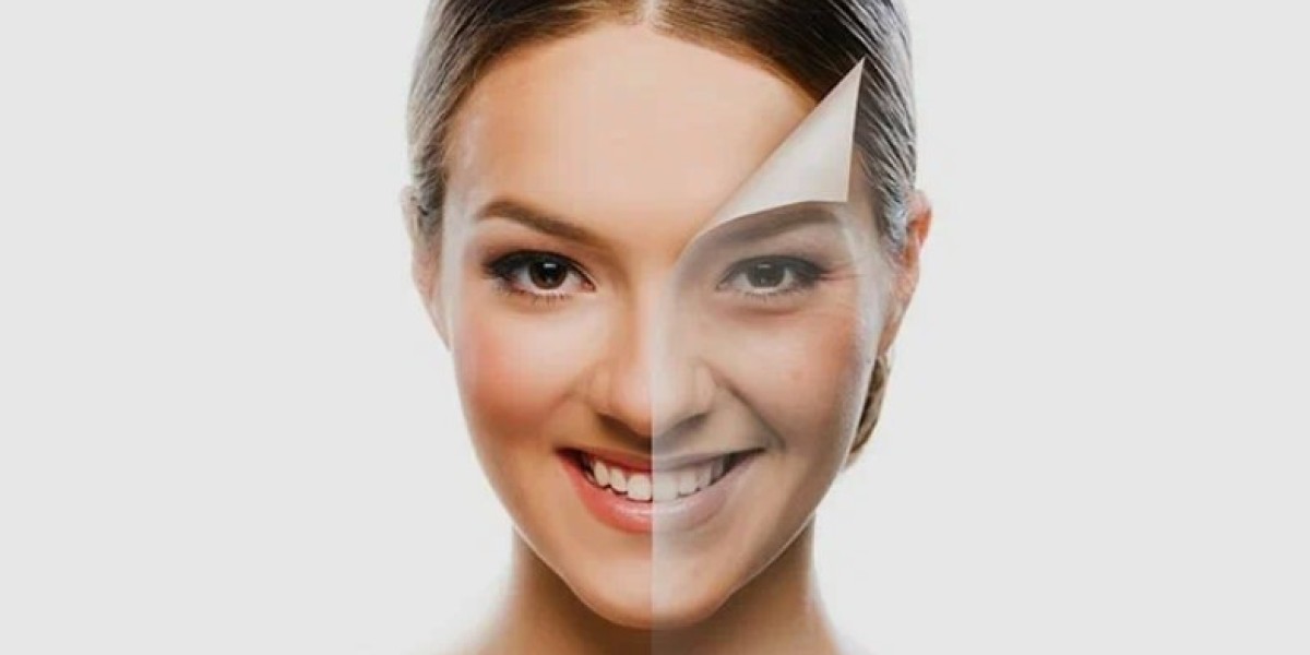 How Long Do Skin Whitening Treatments last