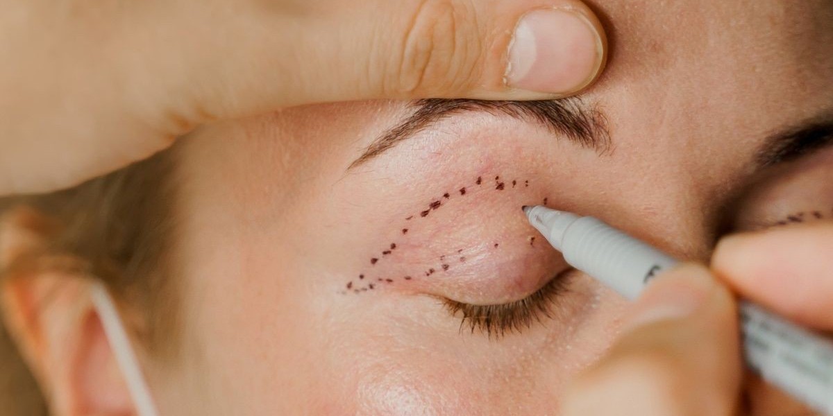 Eyelid Surgery in Riyadh