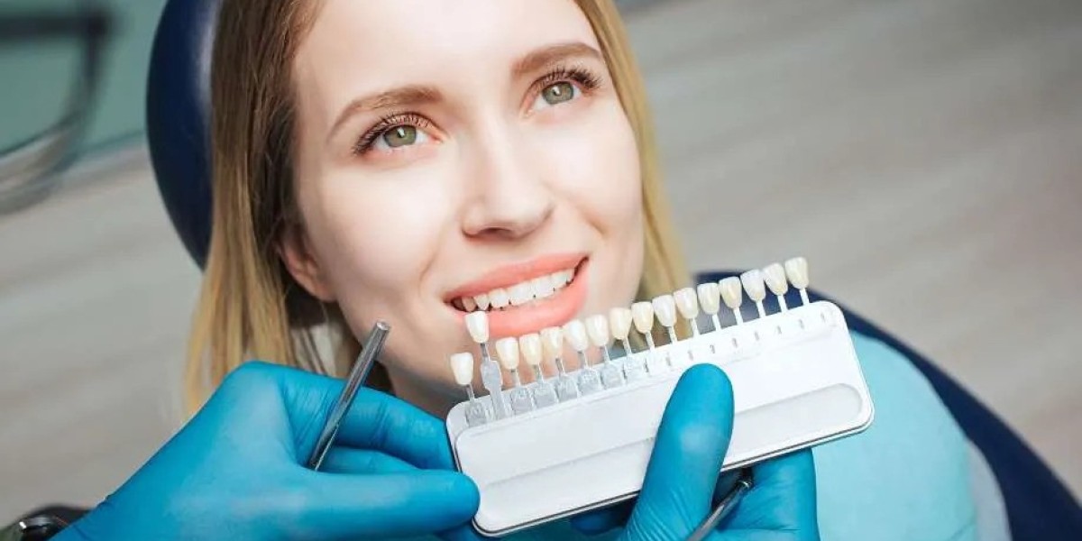 Find the Best Dentist for Veneers in Dubai