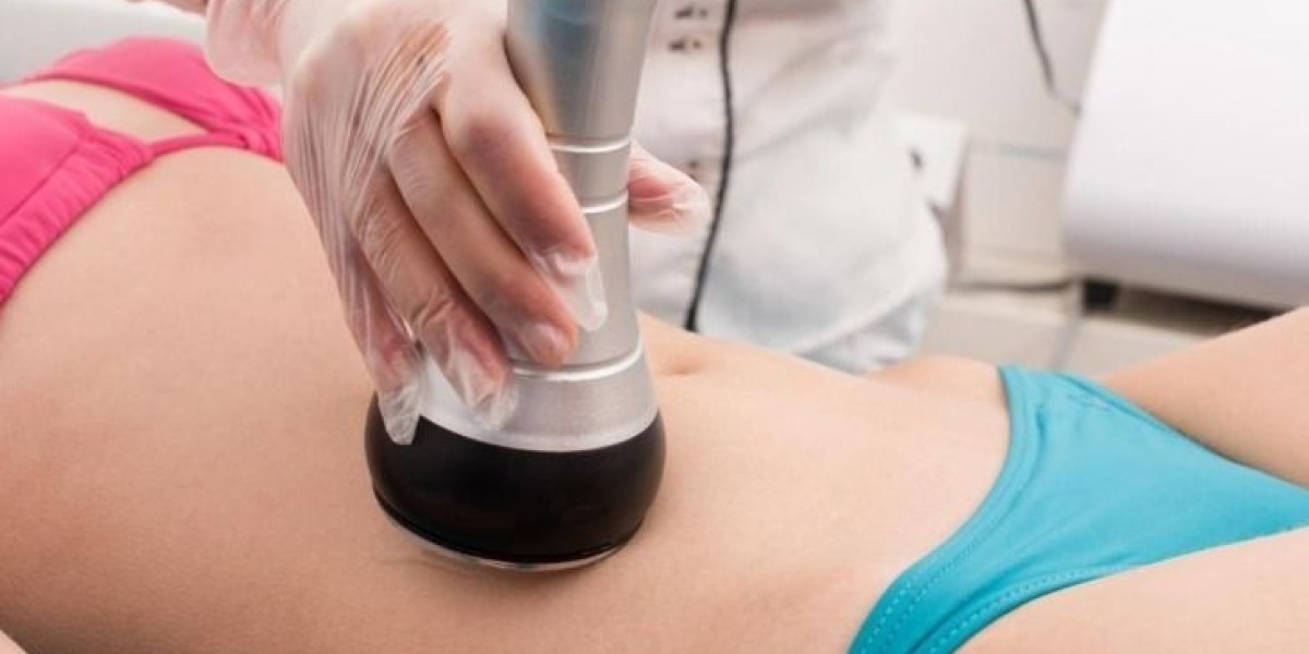 Laser Liposuction vs Traditional Methods Explai