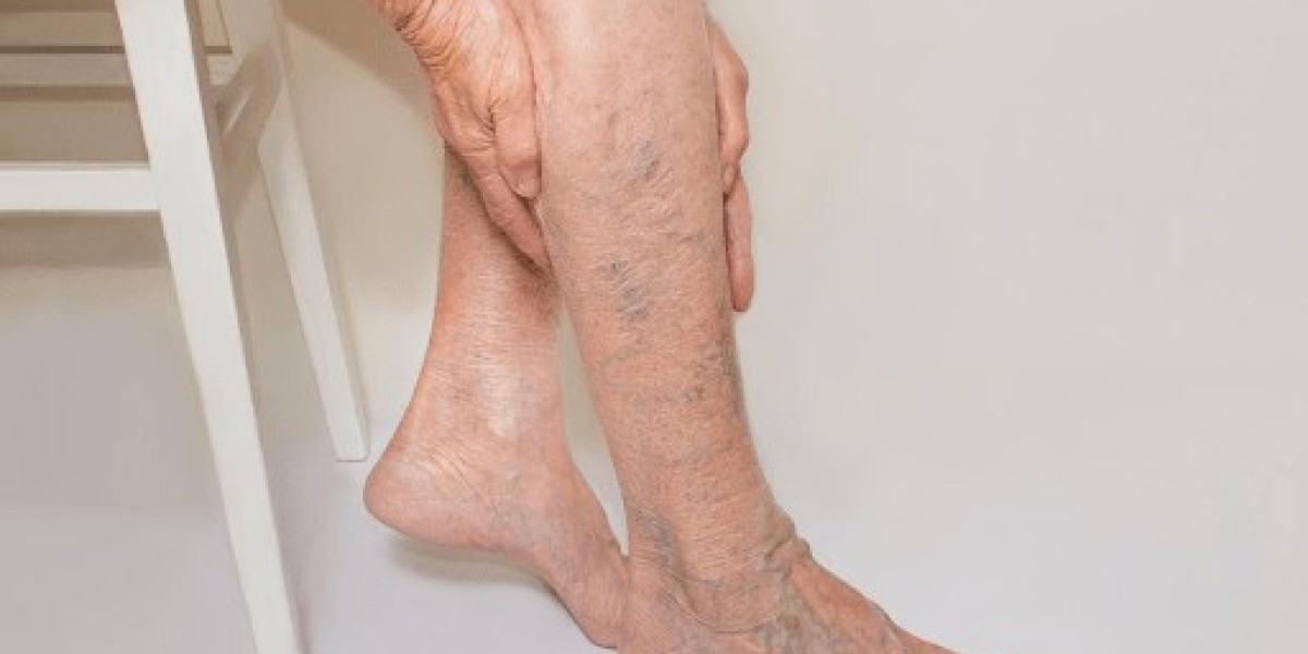 https://www.facebook.com/Venovixil.Vein.Care.Cream.Canada.Reviews/