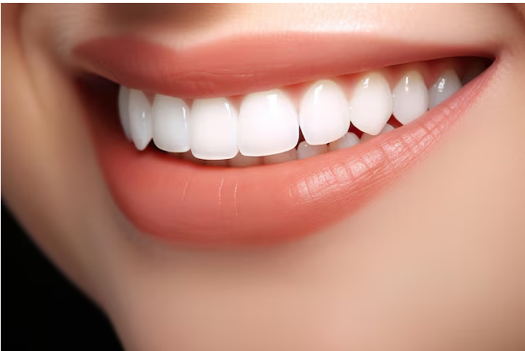Hollywood Smile in Abu Dhabi: Which Treatment Is Right for You?