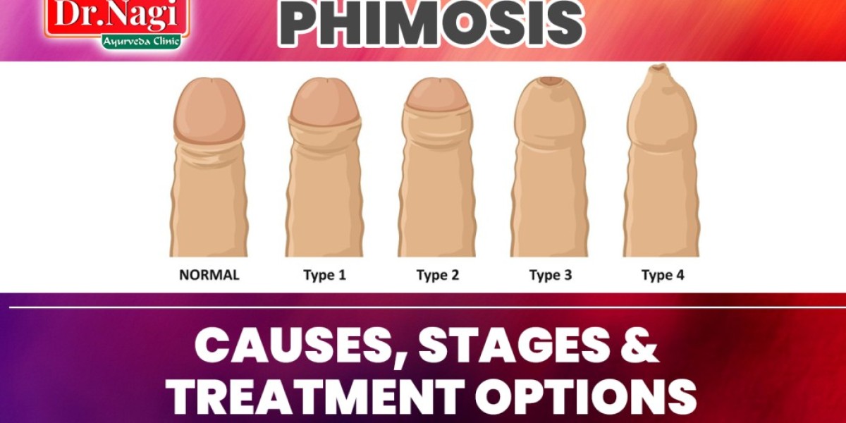 Phimosis: Improving Sexual Health & Wellness
