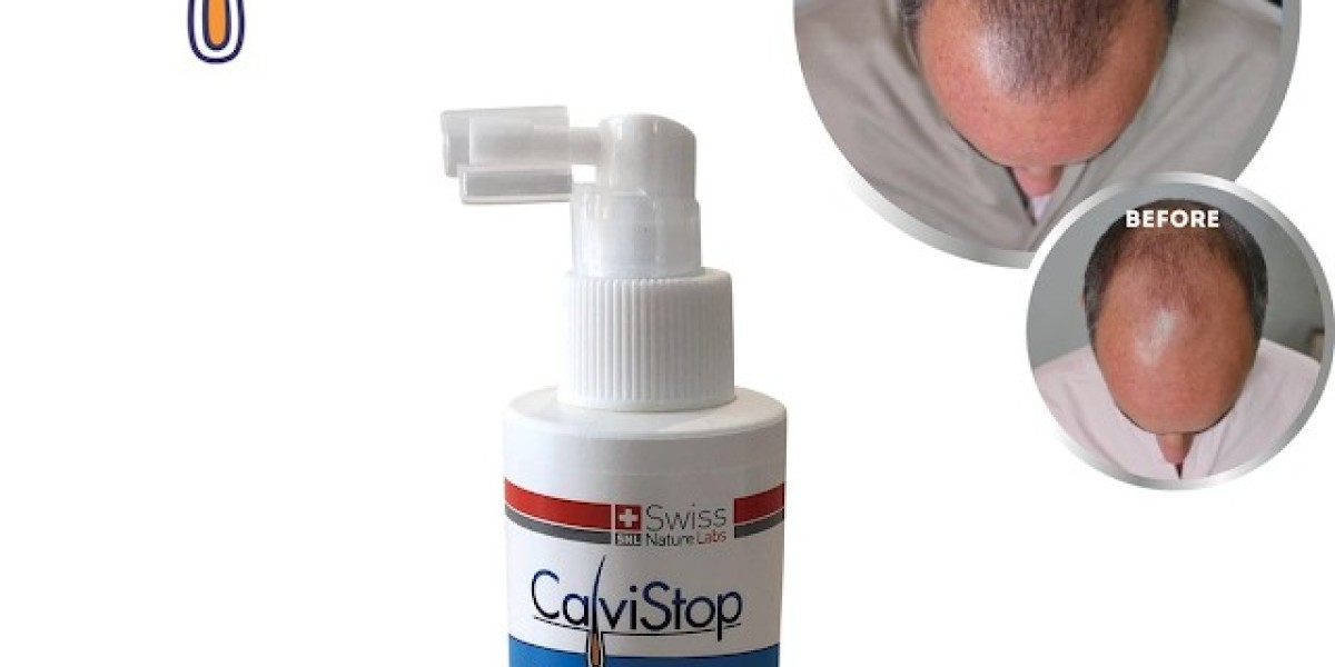 CalviStop™ Hair Loss Treatment For Cure Hair