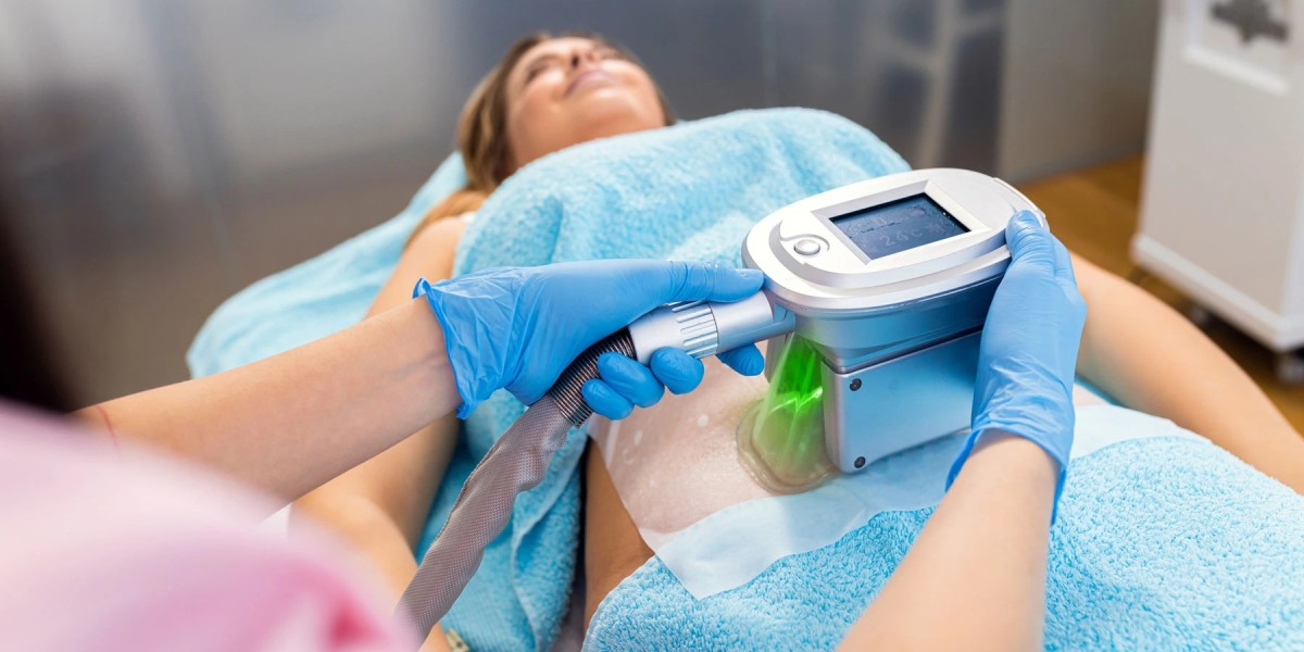 How Many Times Should I Get CoolSculpting?