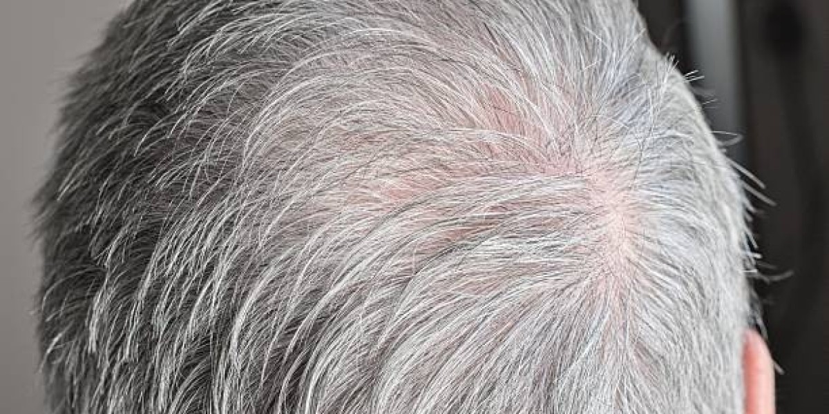 Best Hair dye for grey hair