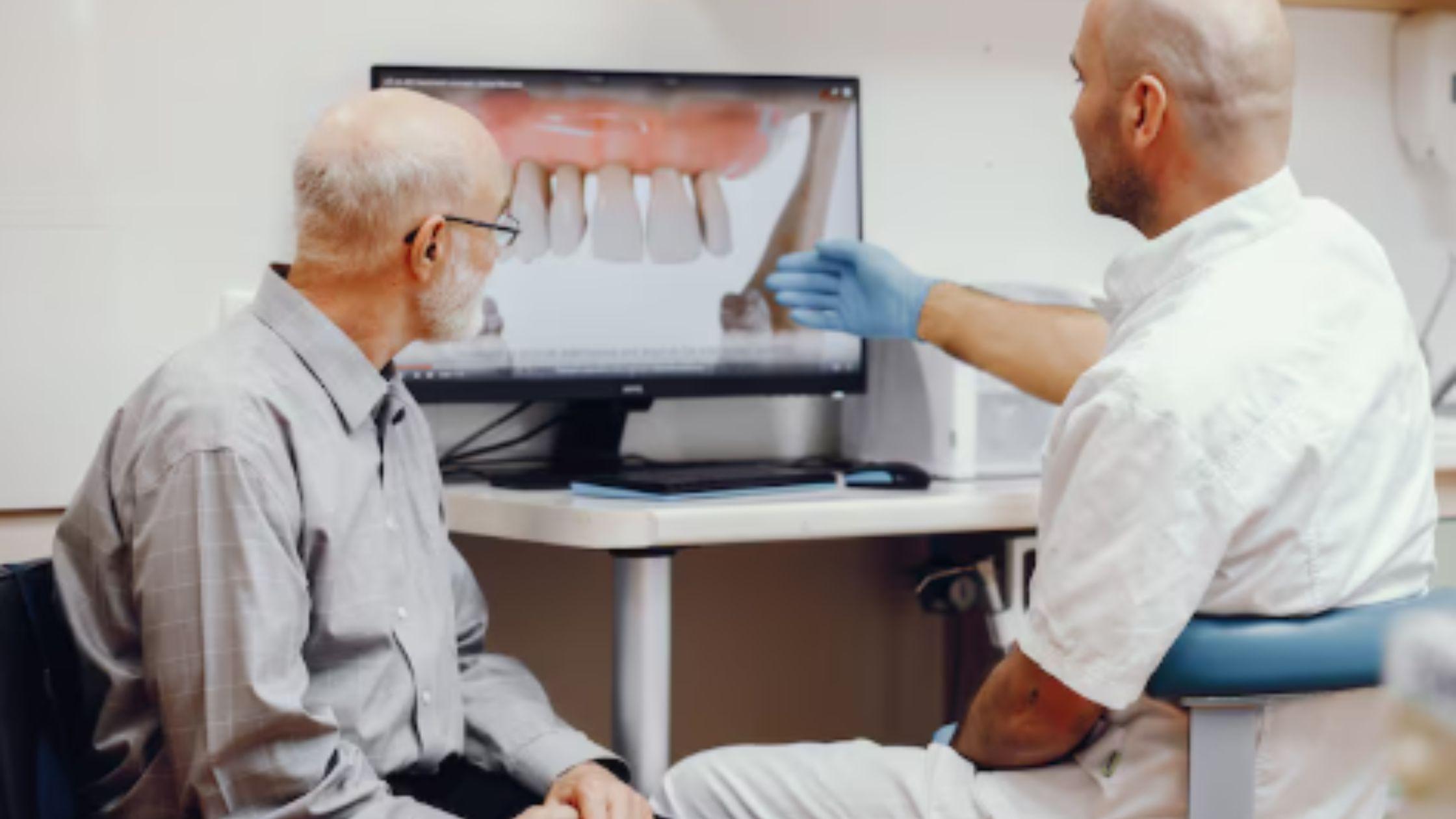 All-on-4 Implants vs. Traditional Implants: Key Differences | Rumor...