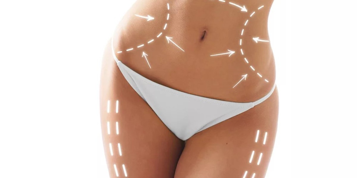 Diet and Exercise After Liposuction: