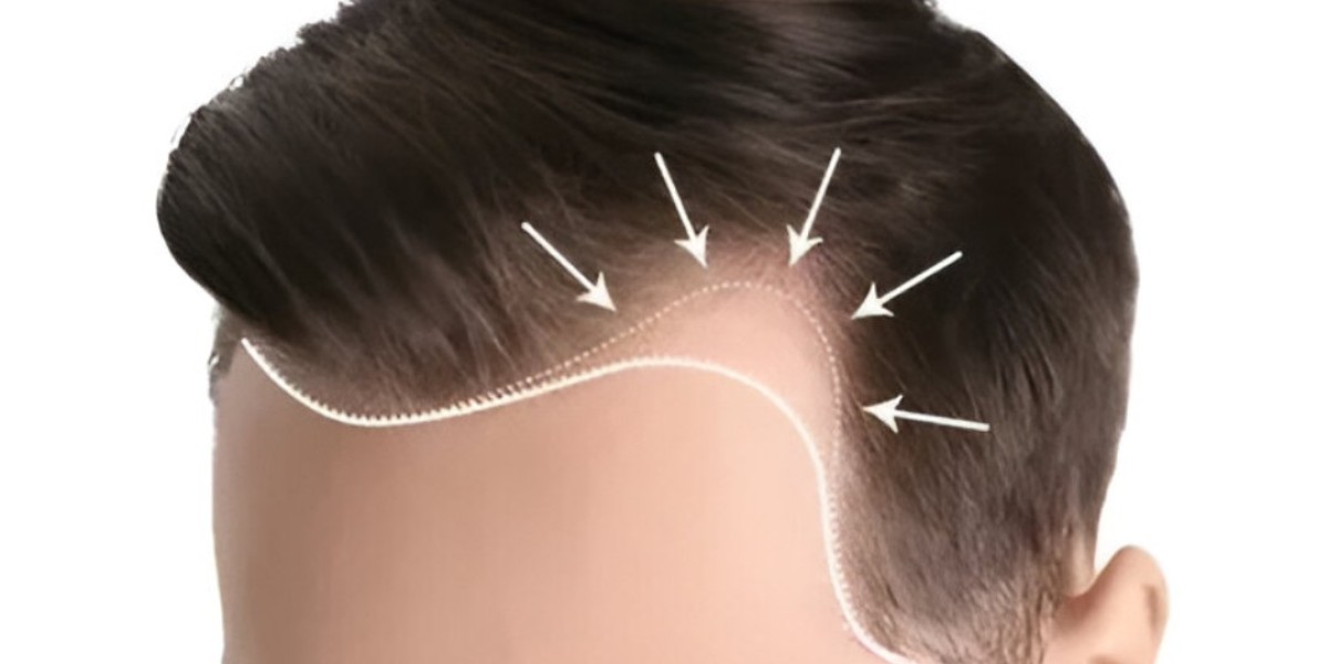 Transform Your Hair Naturally with Exosome Ther