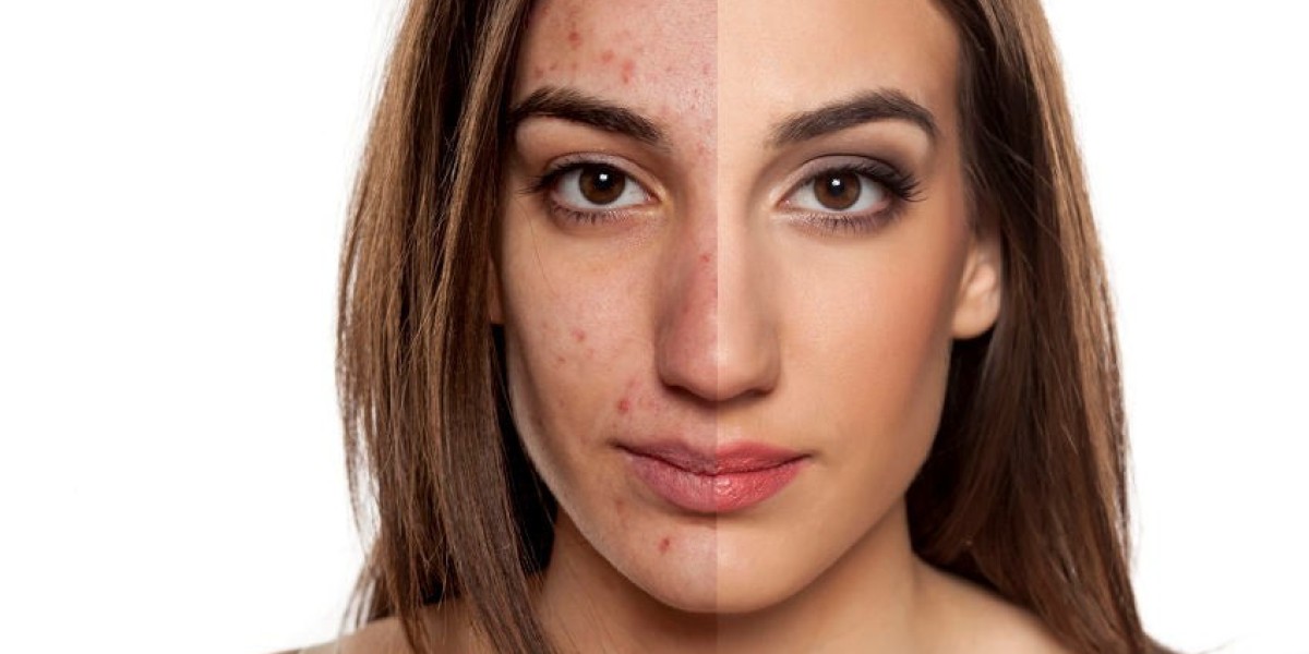 What Results Can You Realistically Expect from