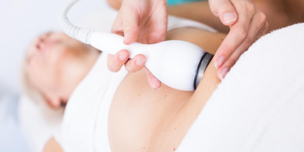 Is Laser Liposuction Safe? What Experts Are Say