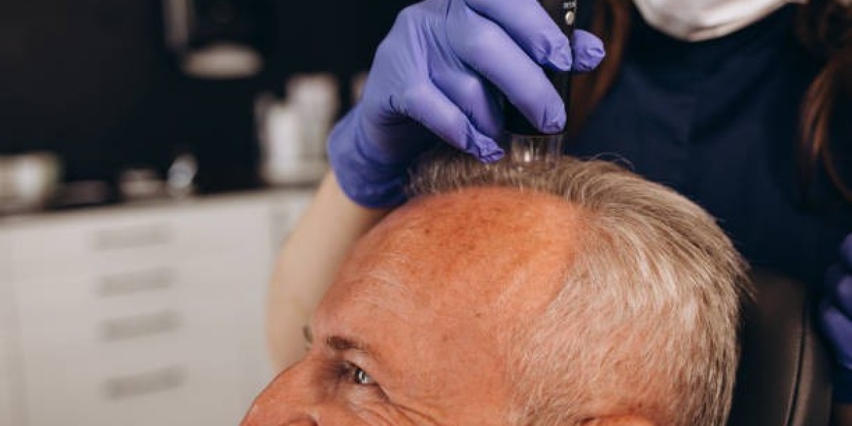 How Exosomes Therapy Transforms Hair Loss Treat