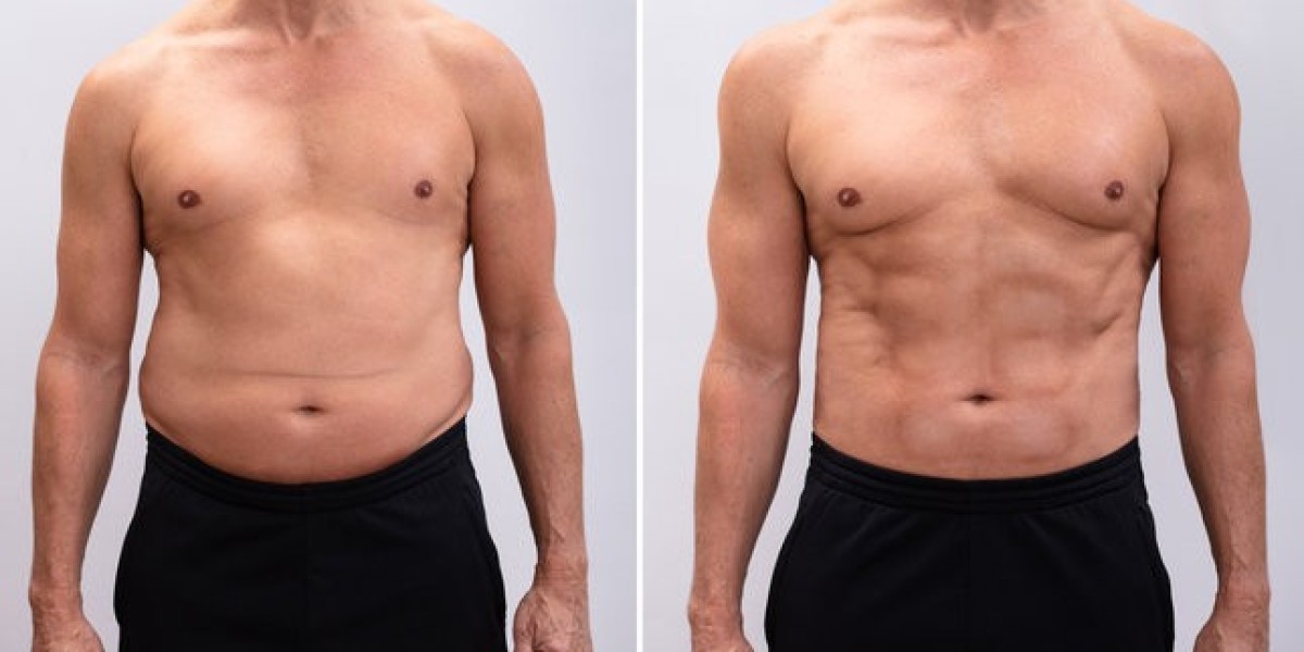 Semaglutide Weight Loss