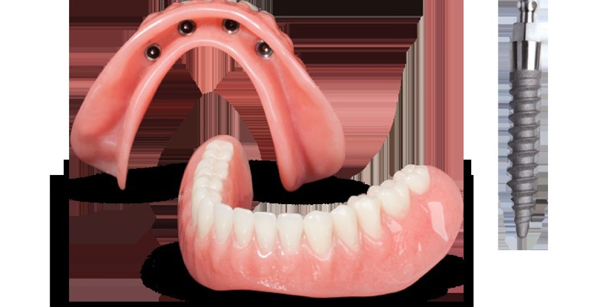 Affordable Mini Dental Implants Chattanooga TN