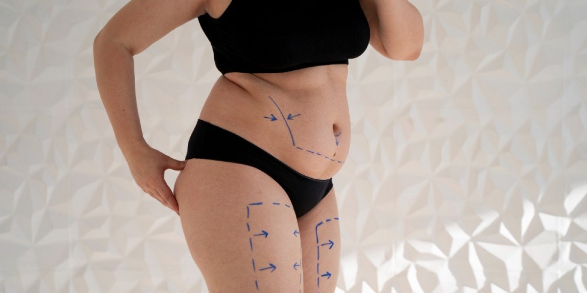 Get the Confidence You Deserve – Liposuction Th