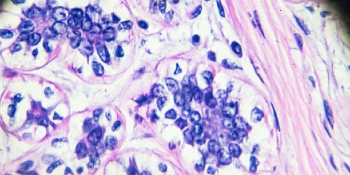 Breast Biopsy Devices Market Growth: Innovation