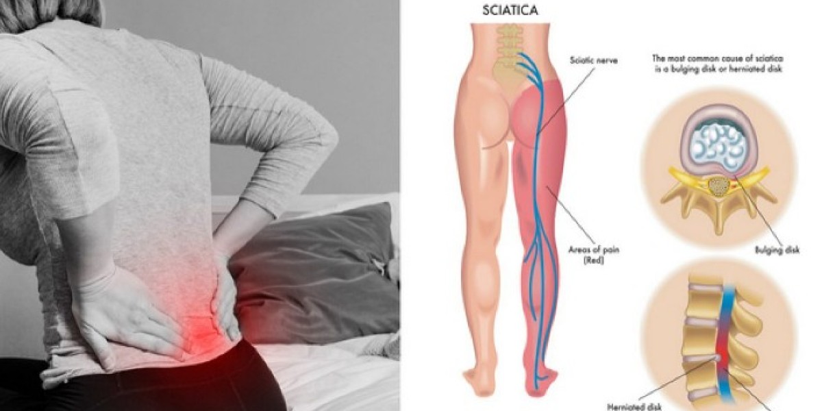 https://www.facebook.com/SciaticylSciaticPain.Get/