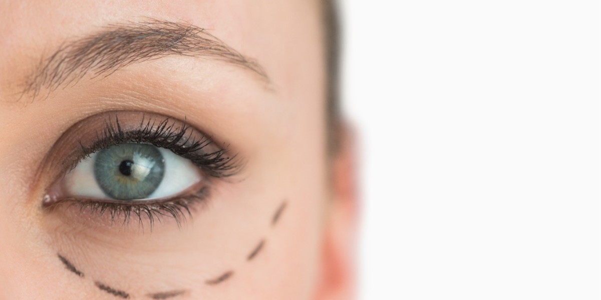 Combining Eyelid Surgery With Other Cosmetic Pr