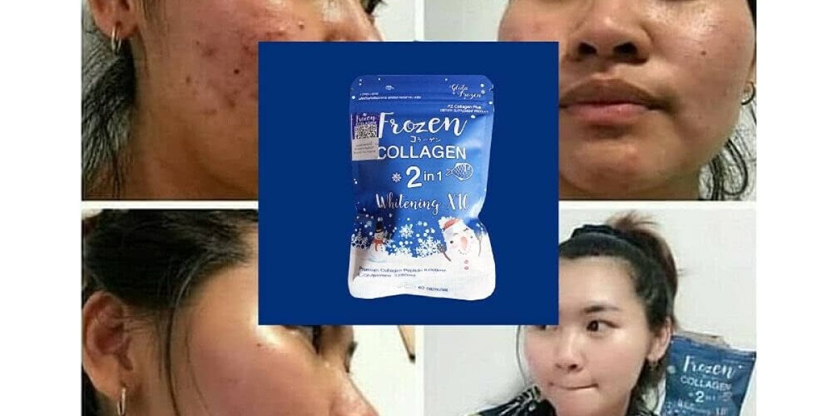 Frozen Collagen 2 in 1: A Complete Review
