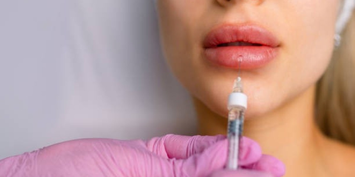 Lip Fillers Injection in Dubai: Post-Treatment
