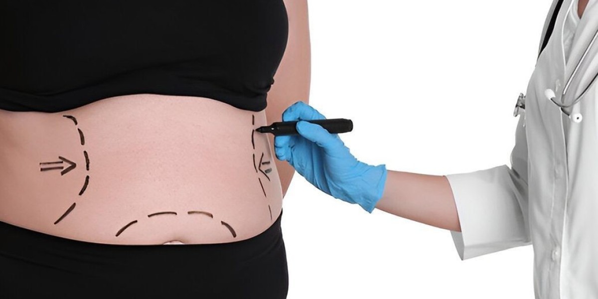 How Bariatric Surgery Improves Long-Term Health