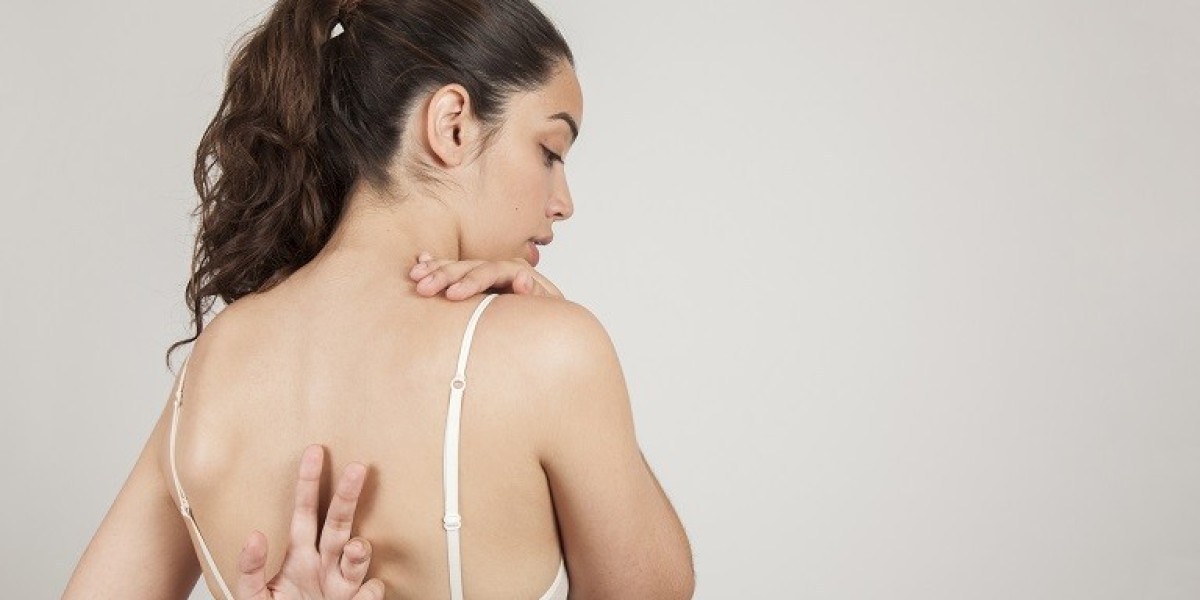 How to Treat Back Acne and Prevent Future Break