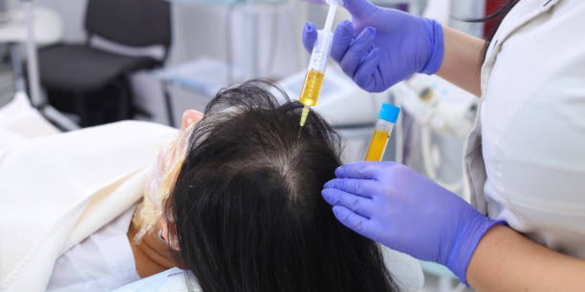 What to Expect from a PRP Hair Treatment Proced