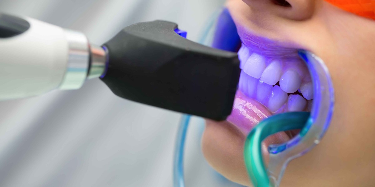 Teeth Whitening Packages and Prices