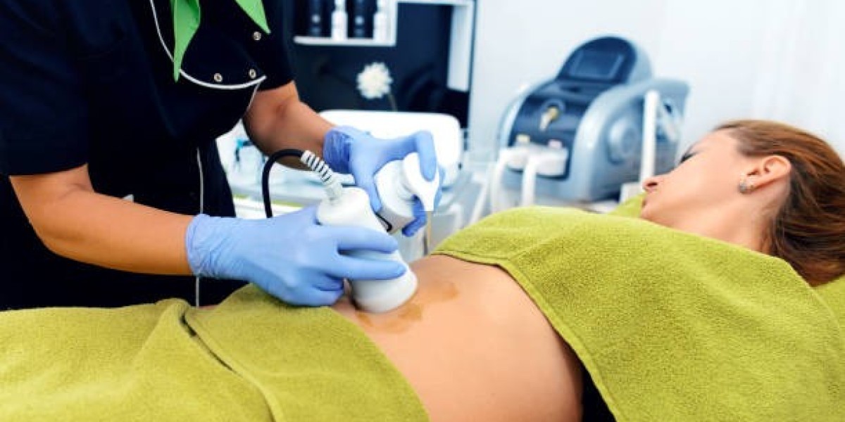 Benefits of Choosing Laser Liposuction in Riyad