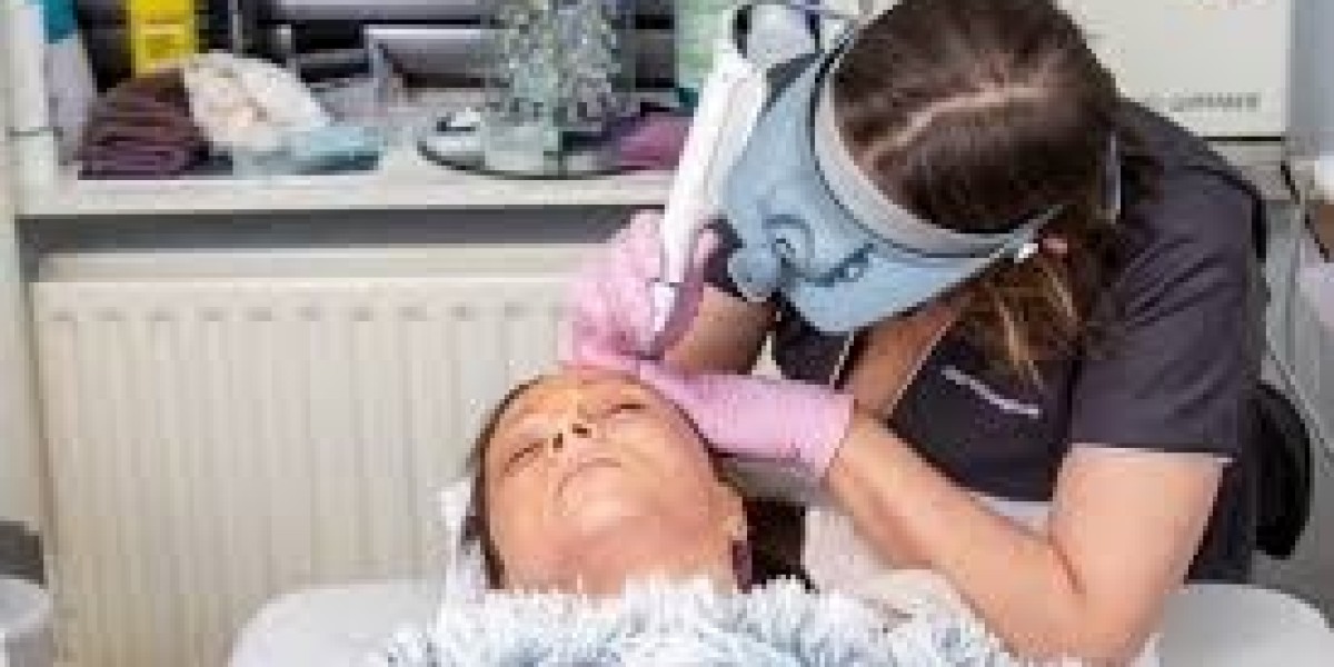 Golden RF Microneedling Cork – Transform Your S