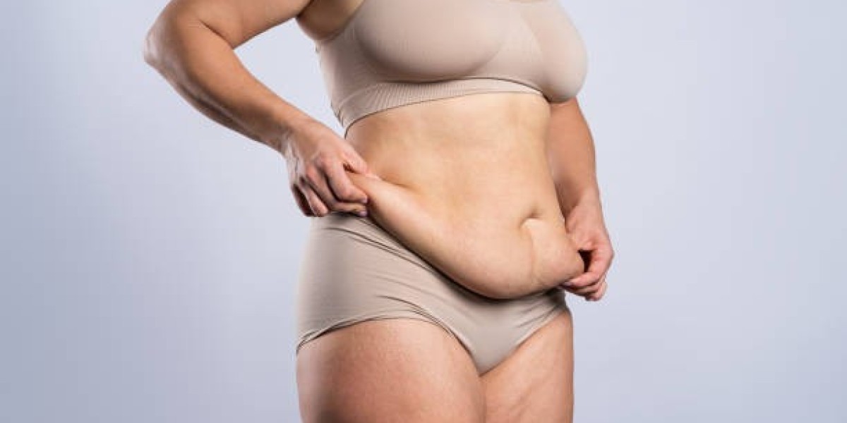 Liposuction in Riyadh: Frequently Asked