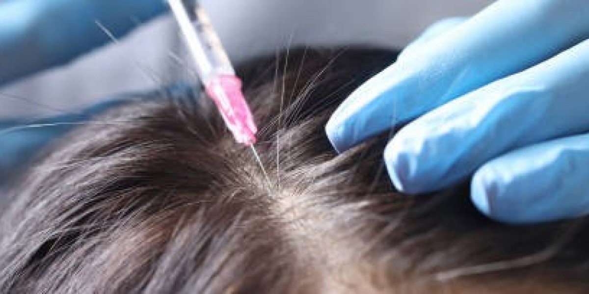 PRP Hair Treatment in Delhi – A Natural Solutio