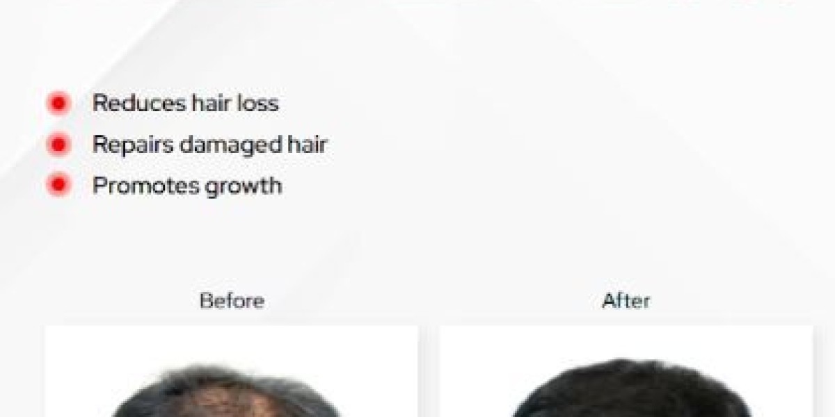 CalviStop™ Anticaída del cabello ¿Cómo puedo ut